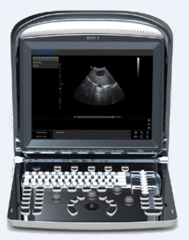 Eco 3 Ultrasound System - Công Ty TNHH Med Gyn Vina